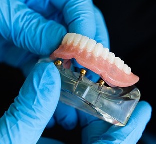 Prothèse dentaire provisoire en Hongrie - Dentaphil