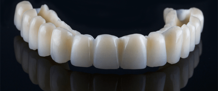 Prothèse dentaire provisoire en Hongrie - Dentaphil